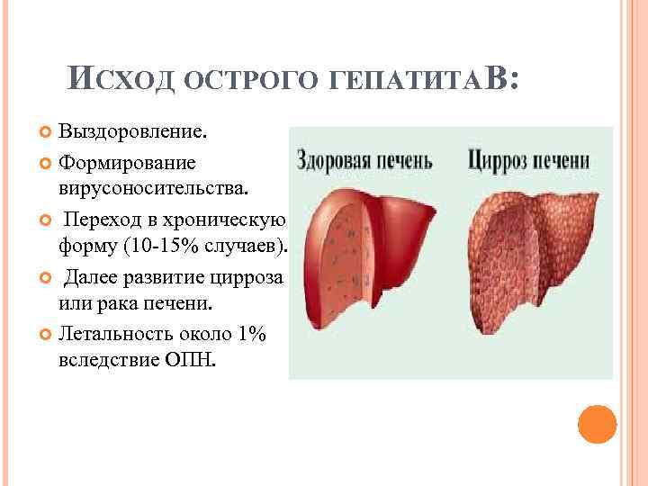 ИСХОД ОСТРОГО ГЕПАТИТА В: Выздоровление. Формирование вирусоносительства. Переход в хроническую форму (10 15% случаев).