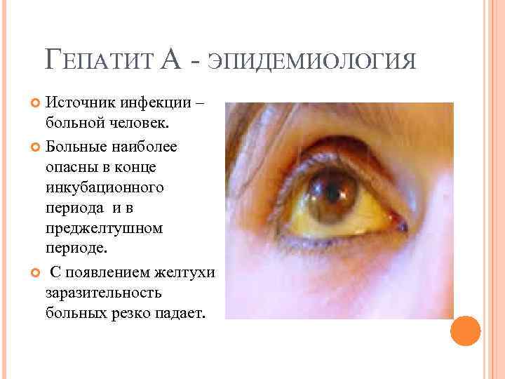 ГЕПАТИТ А ЭПИДЕМИОЛОГИЯ Источник инфекции – больной человек. Больные наиболее опасны в конце инкубационного
