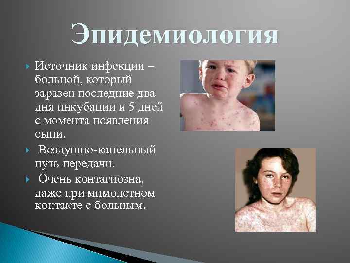 Эпидемиология Источник инфекции – больной, который заразен последние два дня инкубации и 5 дней