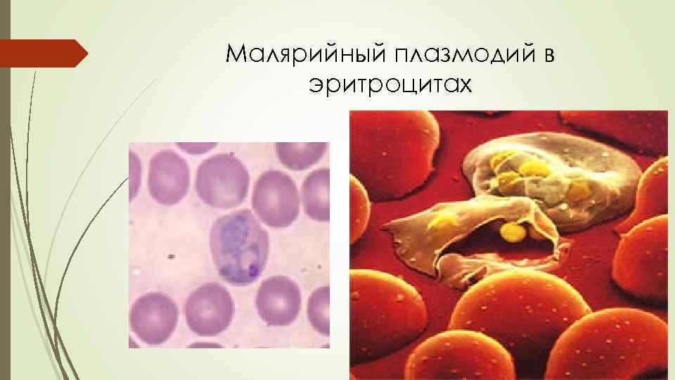 Малярийный плазмодий в эритроцитах 