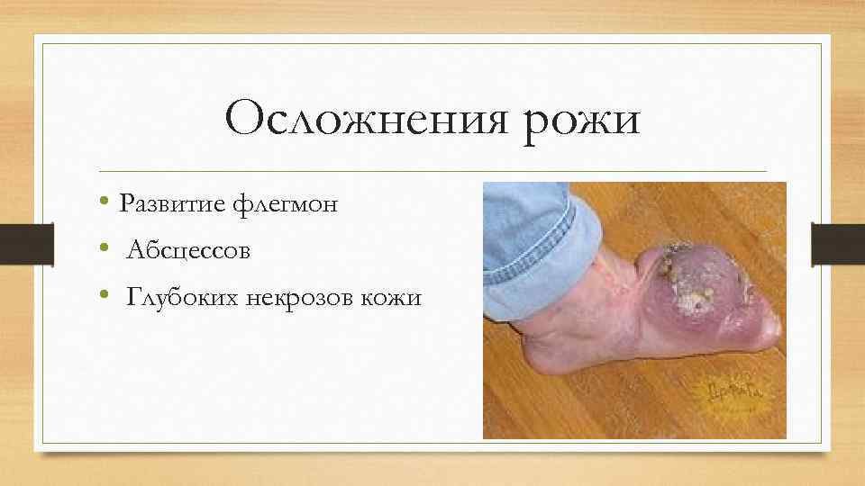 Осложнения рожи • Развитие флегмон • Абсцессов • Глубоких некрозов кожи 