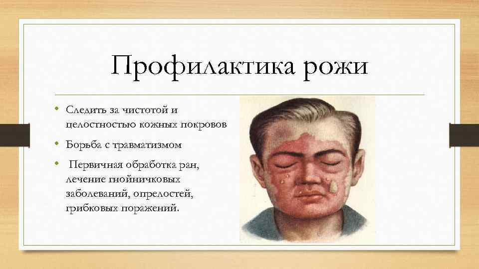 Профилактика рожи • Следить за чистотой и целостностью кожных покровов • Борьба с травматизмом