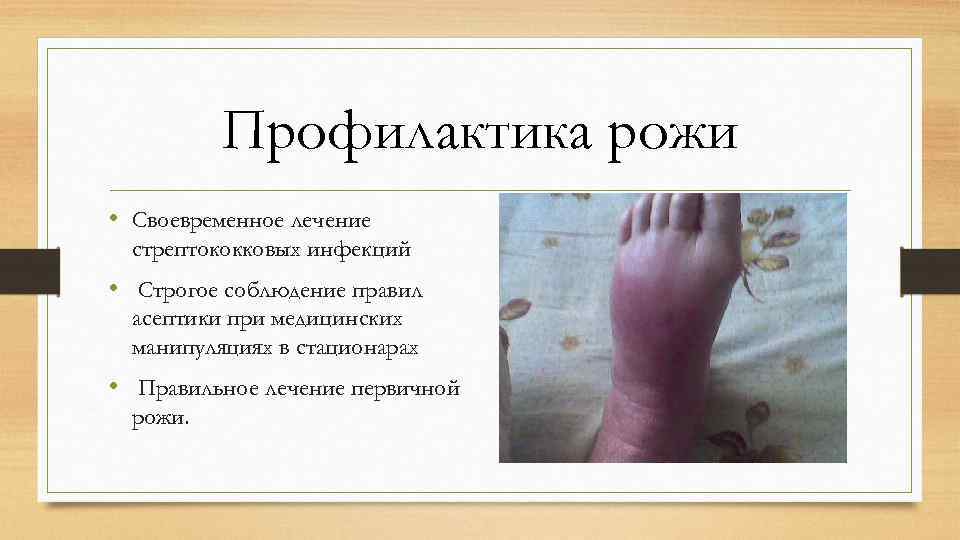 Профилактика рожи • Своевременное лечение стрептококковых инфекций • Строгое соблюдение правил асептики при медицинских