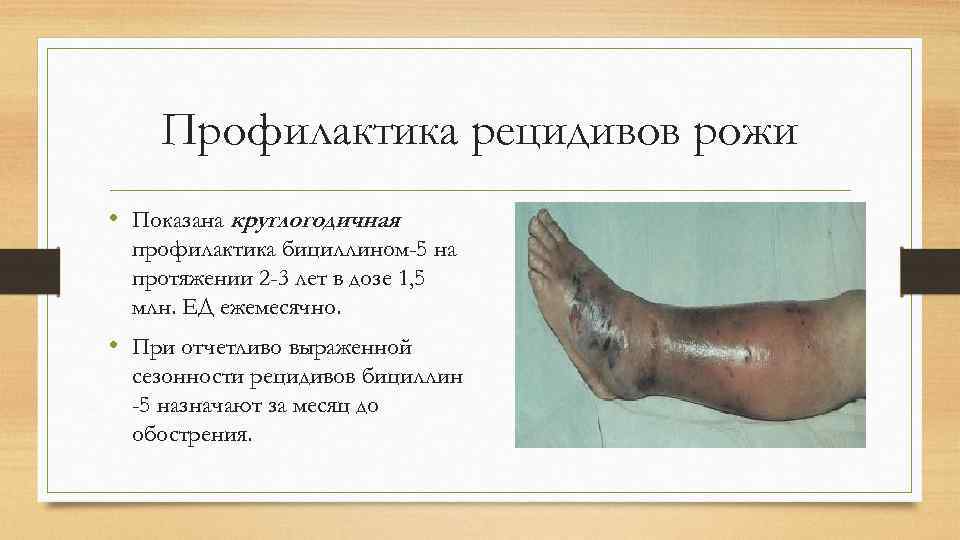 Профилактика рецидивов рожи • Показана круглогодичная профилактика бициллином-5 на протяжении 2 -3 лет в