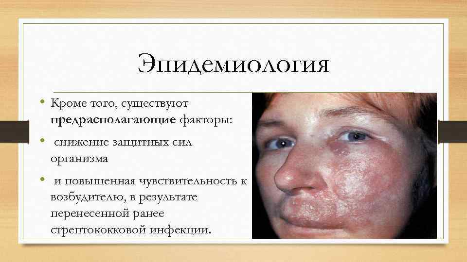 Эпидемиология • Кроме того, существуют предрасполагающие факторы: • снижение защитных сил организма • и