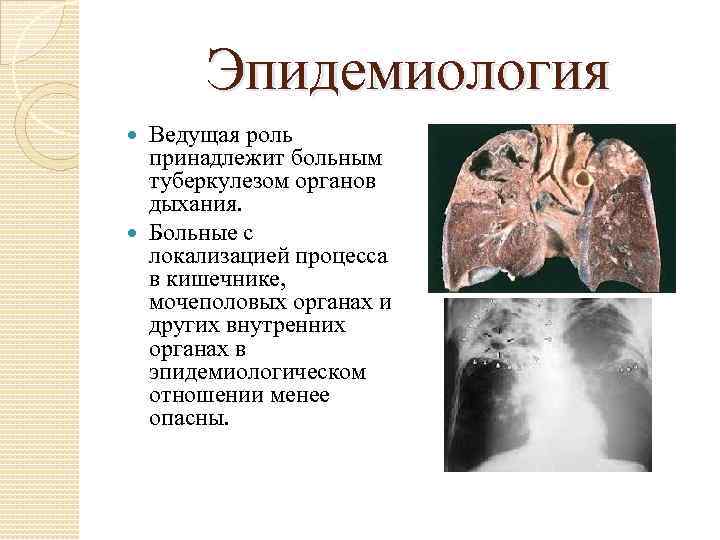 Эпидемиология Ведущая роль принадлежит больным туберкулезом органов дыхания. Больные с локализацией процесса в кишечнике,