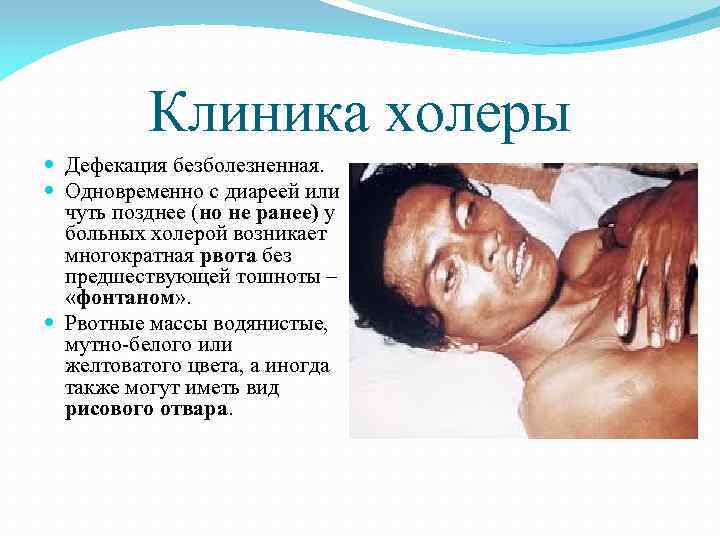 Клиника холеры Дефекация безболезненная. Одновременно с диареей или чуть позднее (но не ранее) у