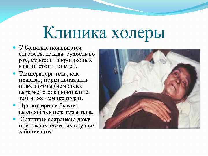 Клиника холеры У больных появляются слабость, жажда, сухость во рту, судороги икроножных мышц, стоп