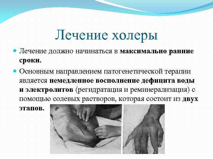 Лечение холеры Лечение должно начинаться в максимально ранние сроки. Основным направлением патогенетической терапии является
