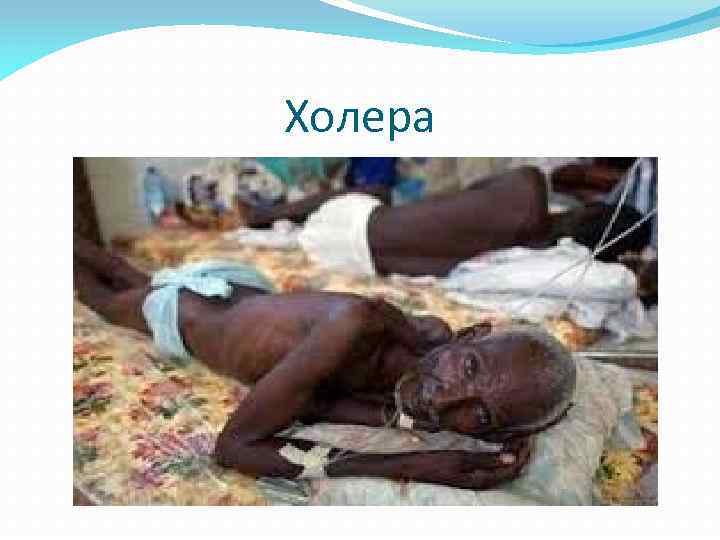 Холера 