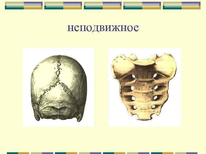 Неподвижное соединение костей