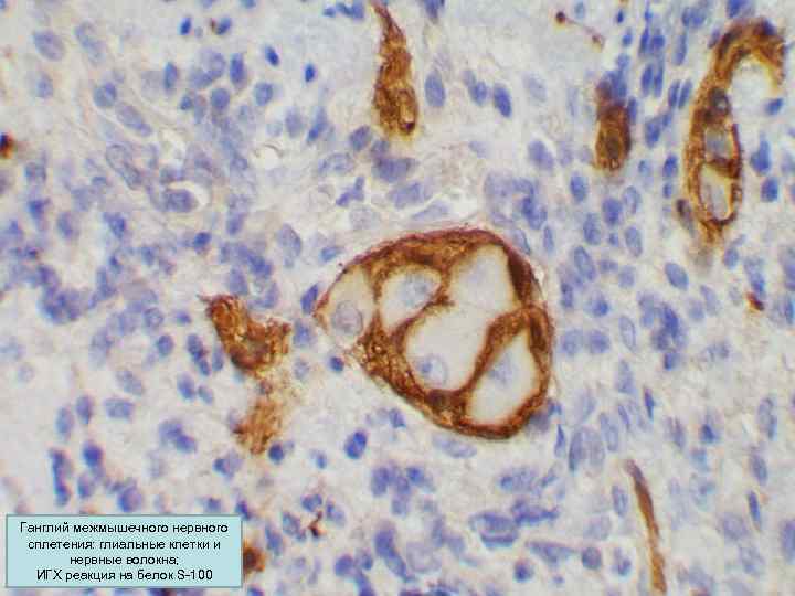 Ганглий межмышечного нервного сплетения: глиальные клетки и нервные волокна; ИГХ реакция на белок S-100