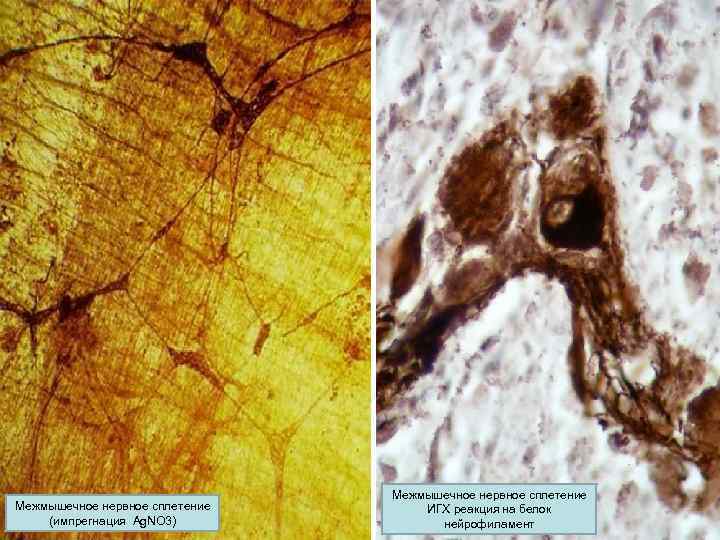 Межмышечное нервное сплетение (импрегнация Ag. NO 3) Межмышечное нервное сплетение ИГХ реакция на белок
