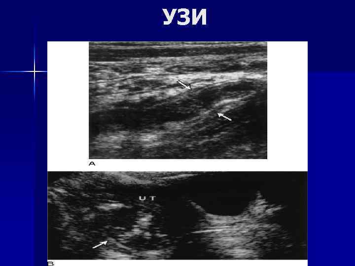 УЗИ 