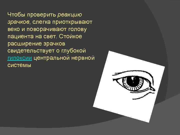 Чтобы проверить реакцию зрачков, слегка приоткрывают веко и поворачивают голову пациента на свет. Стойкое
