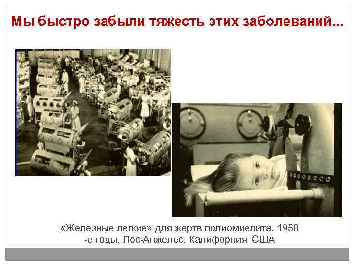 Мы быстро забыли тяжесть этих заболеваний. . . «Железные легкие» для жертв полиомиелита. 1950