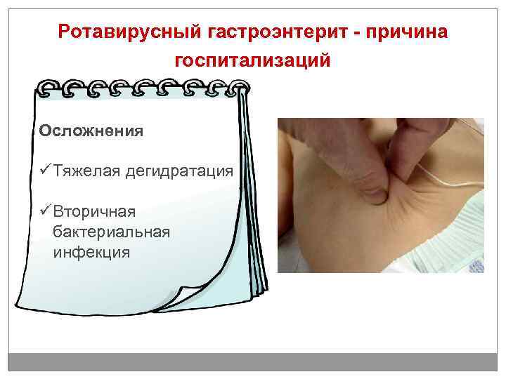 Ротавирусный гастроэнтерит - причина госпитализаций Осложнения Тяжелая дегидратация Вторичная бактериальная инфекция 
