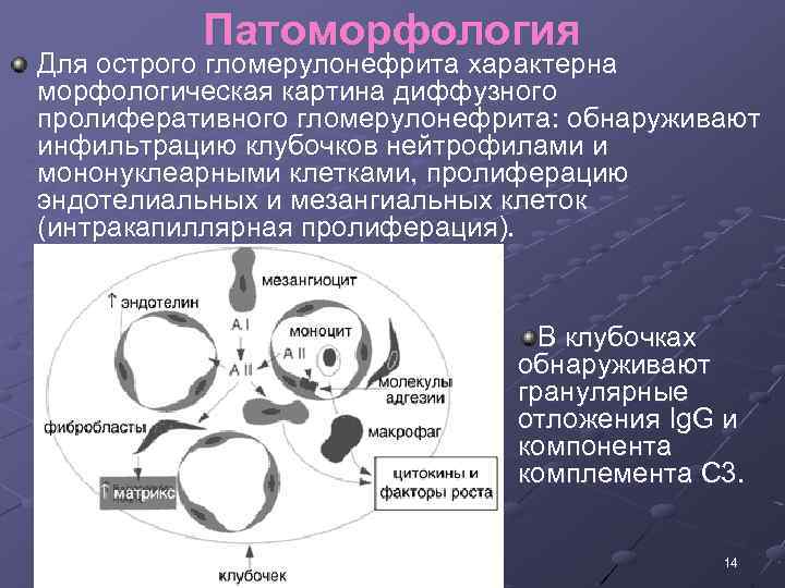 Морфологическая картина гломерулонефрита