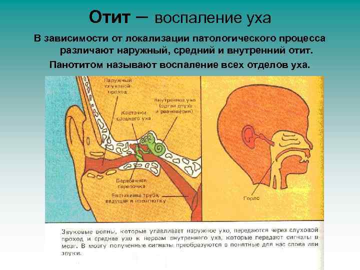 Отит – воспаление уха В зависимости от локализации патологического процесса различают наружный, средний и
