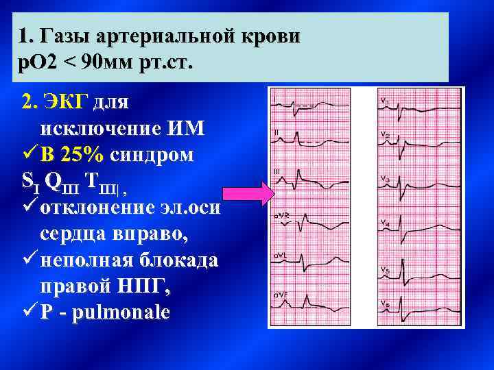 Тромбоэмболия легочной артерии карта вызова