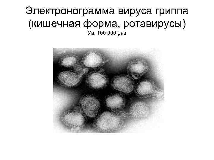 Электронограмма вируса гриппа (кишечная форма, ротавирусы) Ув. 100 000 раз 