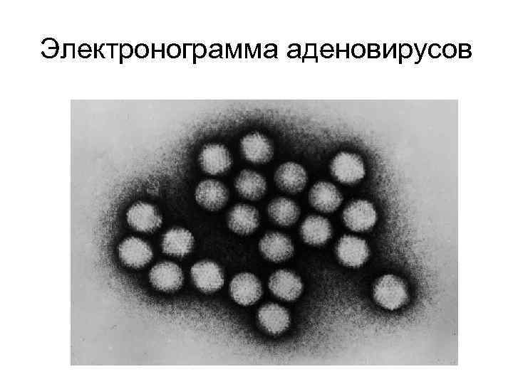 Электронограмма аденовирусов 