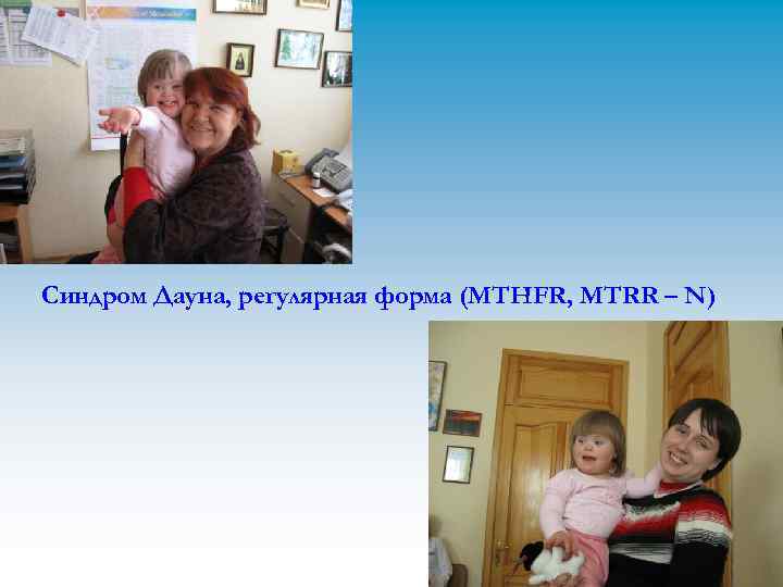 Синдром Дауна, регулярная форма (MTHFR, MTRR – N) 