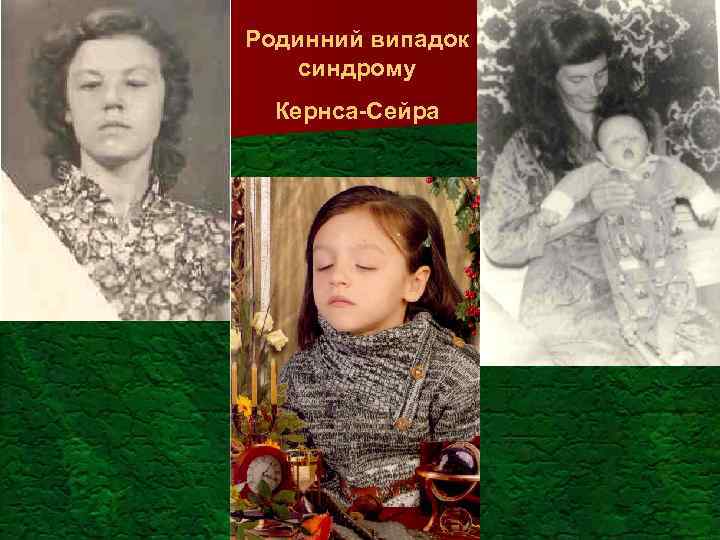 Родинний випадок синдрому Кернса-Сейра 