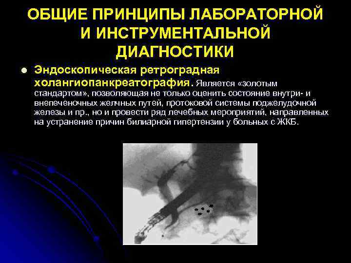 ОБЩИЕ ПРИНЦИПЫ ЛАБОРАТОРНОЙ И ИНСТРУМЕНТАЛЬНОЙ ДИАГНОСТИКИ l Эндоскопическая ретроградная холангиопанкреатография. Является «золотым стандартом» ,