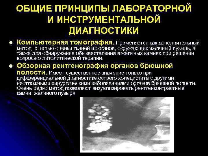 ОБЩИЕ ПРИНЦИПЫ ЛАБОРАТОРНОЙ И ИНСТРУМЕНТАЛЬНОЙ ДИАГНОСТИКИ l Компьютерная томография. Применяется как дополнительный l Обзорная