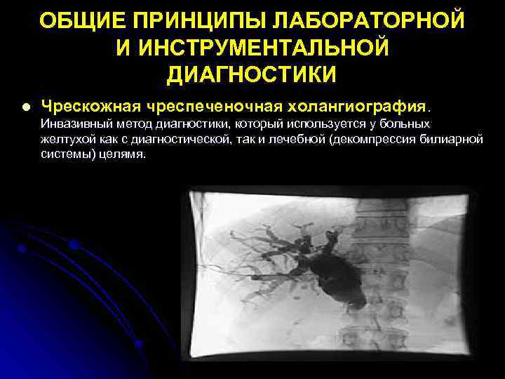 ОБЩИЕ ПРИНЦИПЫ ЛАБОРАТОРНОЙ И ИНСТРУМЕНТАЛЬНОЙ ДИАГНОСТИКИ l Чрескожная чреспеченочная холангиография. Инвазивный метод диагностики, который