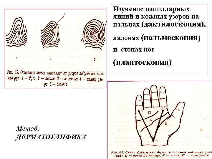 Дерматоглифика виды рисунков значение преобладающих типов