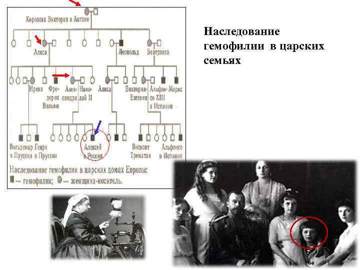 Схема наследования гемофилии