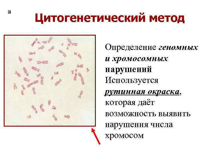 Цитогенетический метод. Цитогенетический метод световая микроскопия. Рутинные методы окраски хромосом. Рутинный метод окрашивания хромосом. Цитогенетический метод окрашивание хромосом.