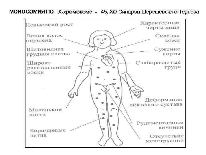 45 хромосом