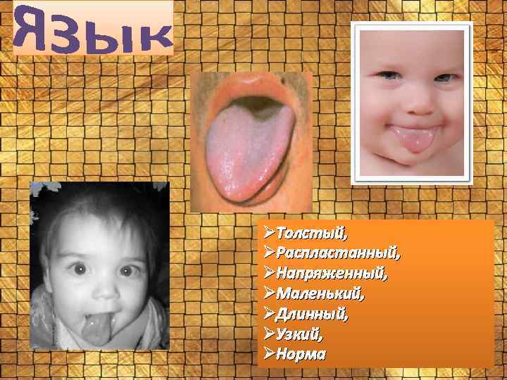 ØТолстый, ØРаспластанный, ØНапряженный, ØМаленький, ØДлинный, ØУзкий, ØНорма 