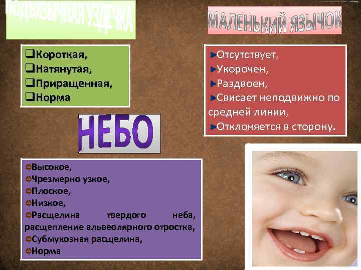 q. Короткая, q. Натянутая, q. Приращенная, q. Норма Высокое, Чрезмерно узкое, Плоское, Низкое, Расщелина