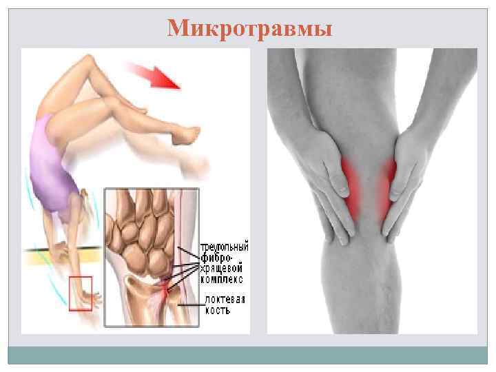 Микротравмы 