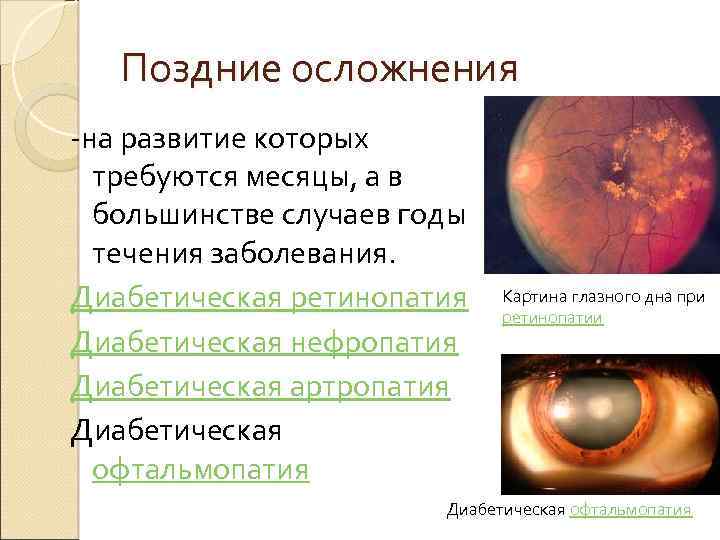 Поздние осложнения -на развитие которых требуются месяцы, а в большинстве случаев годы течения заболевания.