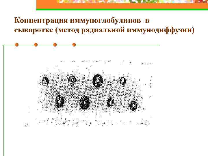 Концентрация иммуноглобулинов в сыворотке (метод радиальной иммунодиффузии) 