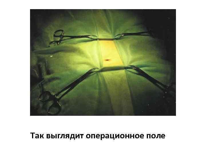 Так выглядит операционное поле 