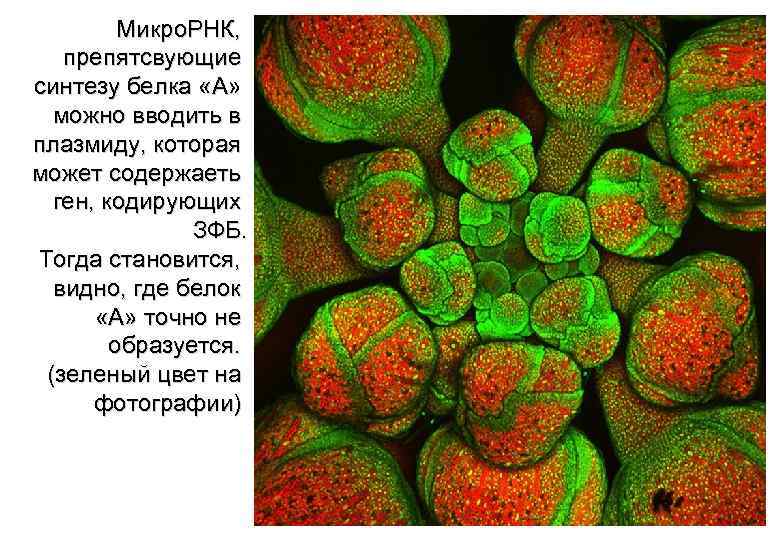 Микро. РНК, препятсвующие синтезу белка «А» можно вводить в плазмиду, которая может содержаеть ген,