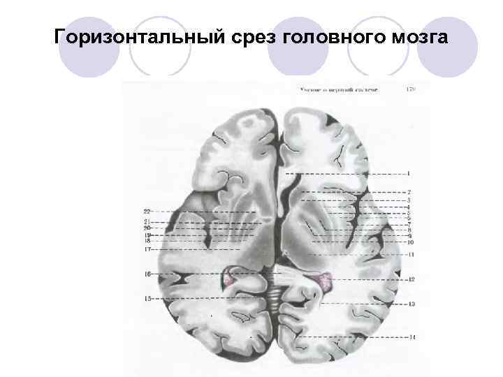 Горизонтальный срез головного мозга 