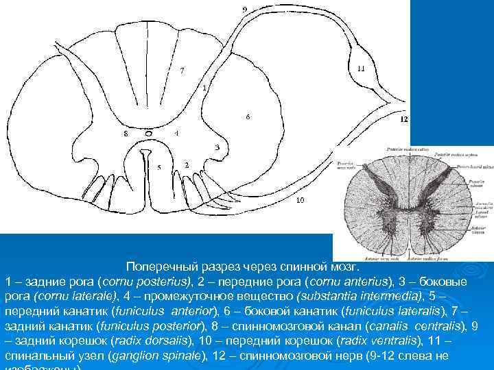 Поперечный разрез через спинной мозг. 1 – задние рога (cornu posterius), 2 – передние