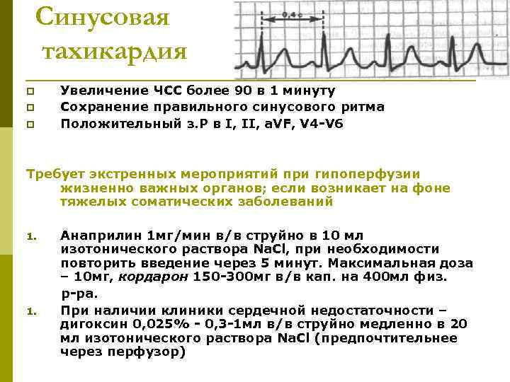 Синусовая тахикардия p p p Увеличение ЧСС более 90 в 1 минуту Сохранение правильного