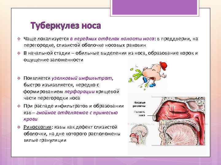 Туберкулез носа v v v Чаще локализуется в передних отделах полости носа: в преддверии,