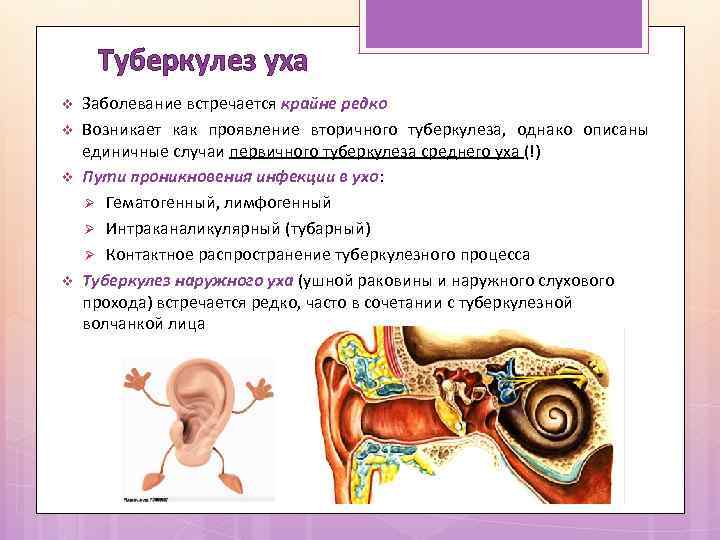 Туберкулез уха v v Заболевание встречается крайне редко Возникает как проявление вторичного туберкулеза, однако