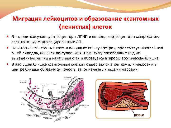 Миграция лейкоцитов и образование ксантомных (пенистых) клеток В эндоцитозе участвуют рецепторы ЛПНП и скэвенджер-рецепторы