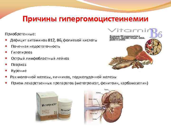 Причины гипергомоцистеинемии Приобретенные: Дефицит витаминов В 12, В 6, фолиевой кислоты Почечная недостаточность Гипотиреоз