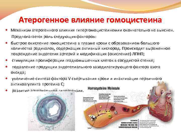 Атерогенное влияние гомоцистеина Механизм атерогенного влияния гипергомоцистеинемии окончательно не выяснен. Предполагается роль следующих факторов: